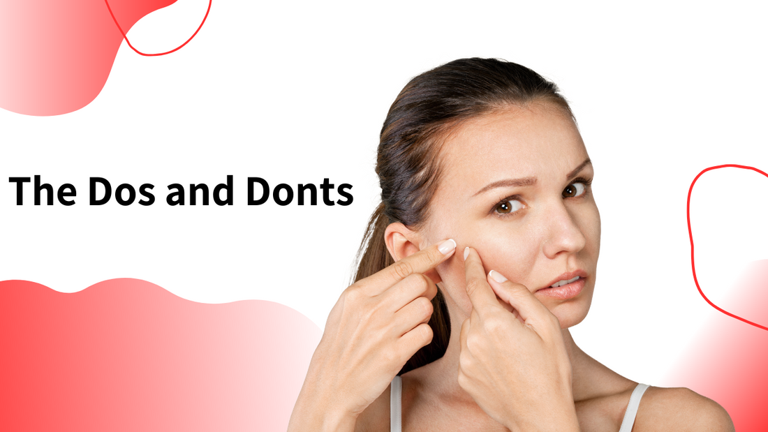 The Dos and Don’ts of Using Pimple Patches